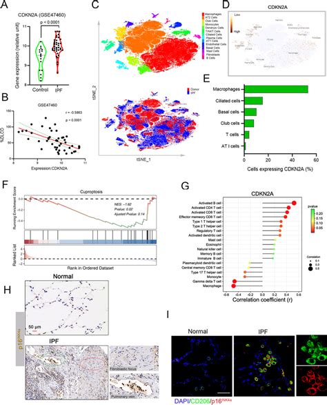 Elevated Expression Of CDKN2A In Patients With IPF A CDKN2A MRNA