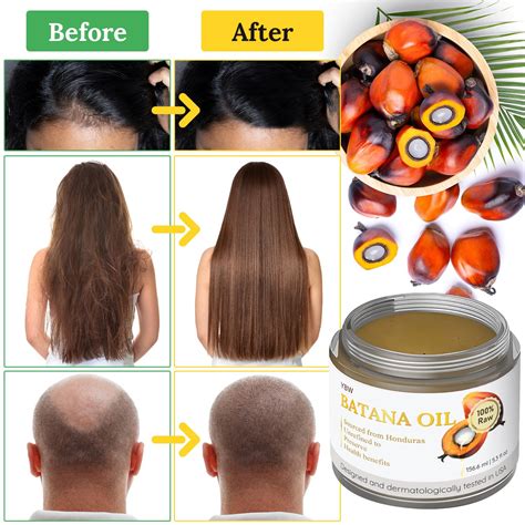 Raw Batana Oil For Hair Growth 100 Natural Pure Philippines Ubuy