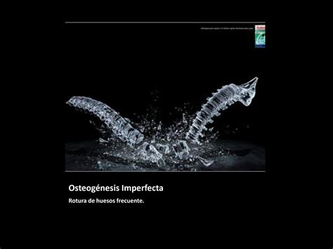 Solution Osteog Nesis Imperfecta Exposicion Studypool