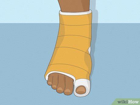 How To Heal A Broken Toe Steps With Pictures Wikihow