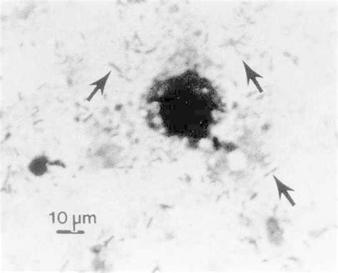 Life Cycle Deadly Bacteria Visits American Convention Legionella Pneumophila