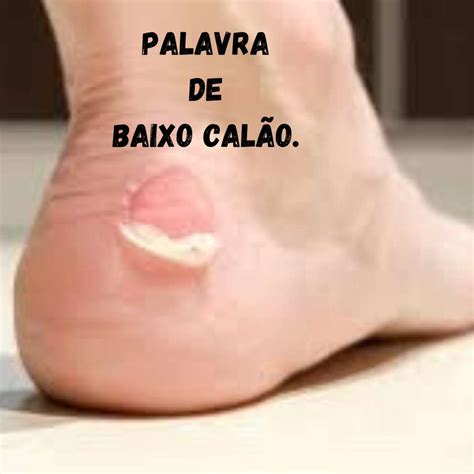 Palavra De Baixo Escalão - Qual O Correto Palavra De Baixo Calão Ou Escalão - ICEBRAIN