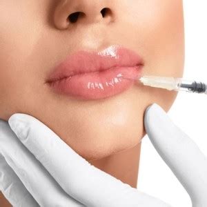 Preenchimento Labial Saiba Tudo Sobre Preenchimento Labial Como