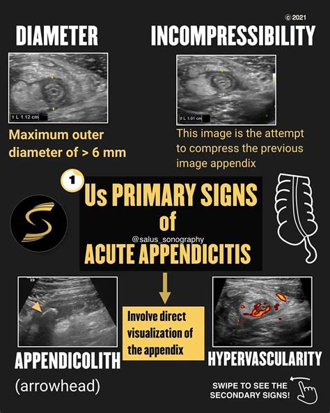 Ultrasound | Education on Instagram: “- There are several ultrasound ...