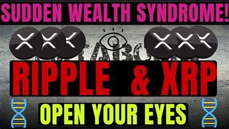 RIPPLE XRP SUDDEN WEALTH SYNDROME XRP HOLDERS OPEN YOUR EYES NOW XRP