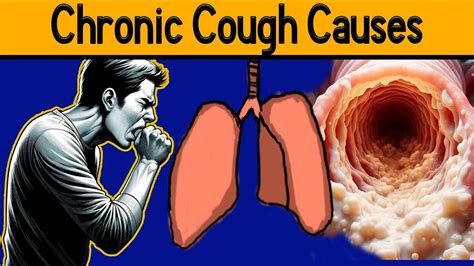 Chronic Cough Causes Why Won T My Cough Go Away Uncover The Top