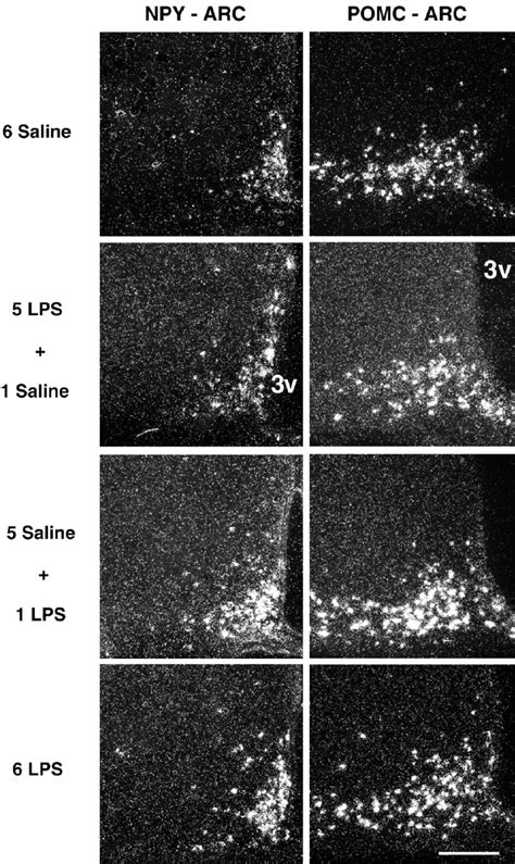 Representative Dark Field Photomicrographs Showing The Distribution Of