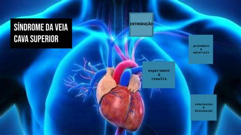 Sindrome Da Veia Cava Superior By Kalliane Santos On Prezi