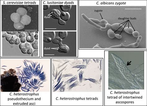 Fungal Sex The Ascomycota Microbiology Spectrum