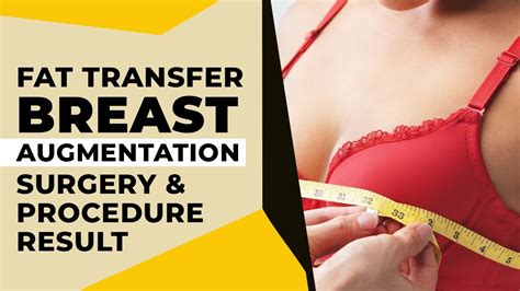 Fat Transfer Breast Augmentation Surgery And Its Result Before After