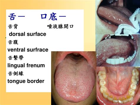 Ppt Oral Mucosa Powerpoint Presentation Free Download Id5775685