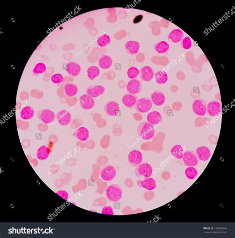 Blood Smear Under Microscope Stock Photo 193979096 | Shutterstock