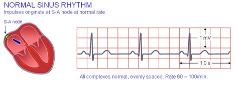 19 The Basis Of Ecg Diagnosis