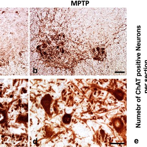 Chronic Mptp Markedly Reduces The Number Of Chat Immunereactive Neurons