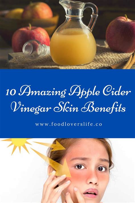 10 Amazing Apple Cider Vinegar Skin Benefits In 2020 Apple Cider Vinegar For Skin Skin