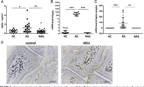 Figure 1 From Leptin Promotes Monosodium Urate CrystalInduced