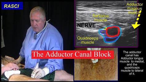 Adductor Nerve Block