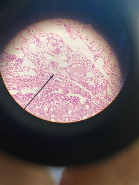 The Structure of Simple Squamous Cells