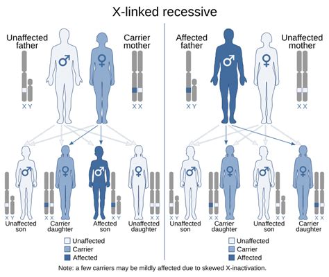 X Linked Recessive Inheritance Wikipedia