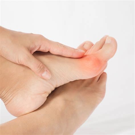 How Do You Relieve Bunion Pain Jeffrey S Muroff Dpm New York