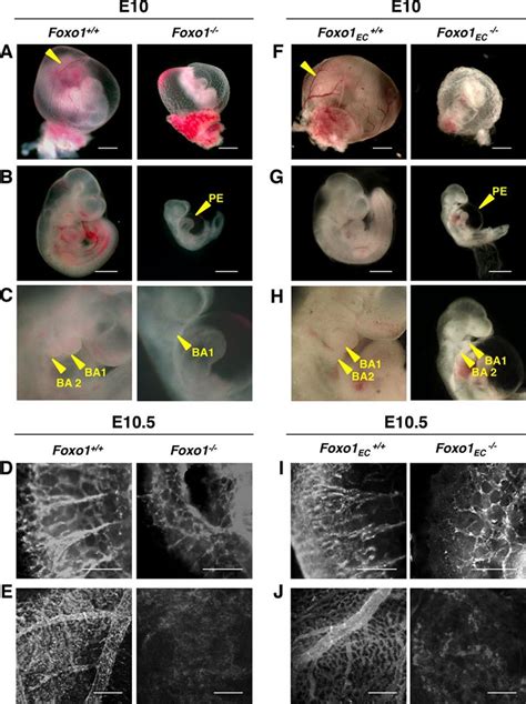 FOXO1 Mediated Activation Of Akt Plays A Critical Role In Vascular