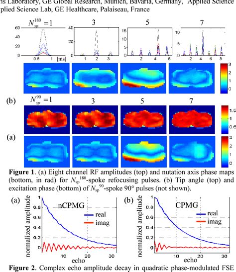 Figure 1 From Fast Spin Echo Imaging With Quadratic Phase Modulated Non Cpmg Echo Train In