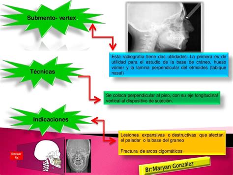 Tecnicas Radiograficas Extrabucales Diapositivas Gabriela Zapata