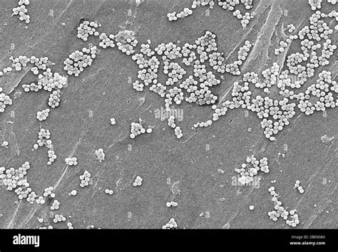 This Scanning Electron Micrograph Depicts A Grouping Of Methicillin