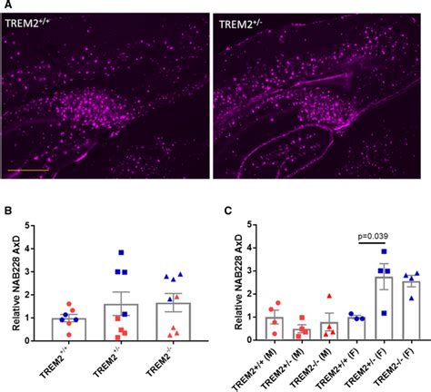 Aβ plaque burden was differentially affected by TREM2 genotype in male