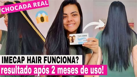 Imecap Hair Antes E Depois Resultado Ap S Meses De Uso Cresceu