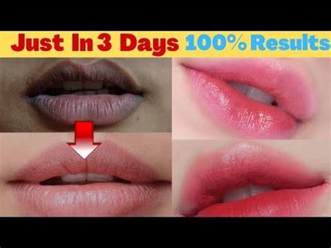 Pink Lips In Three Days Permanently How To Get Pink Lips Naturally