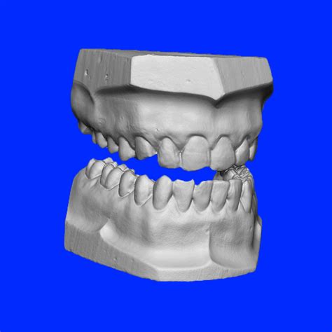 Tooth Universal Numbering System Attention Deficit Disorder