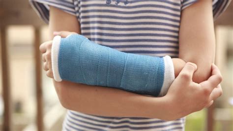 Casts And Splinting Mitchell Integrated Therapy