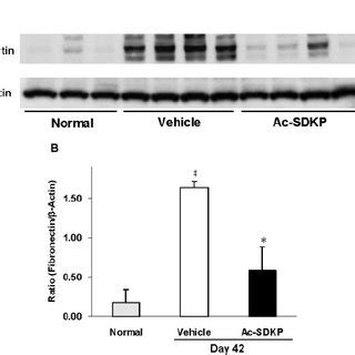 Effects Of Ac Sdkp On Fibronectin Expression In Kidneys From Anti Gbm