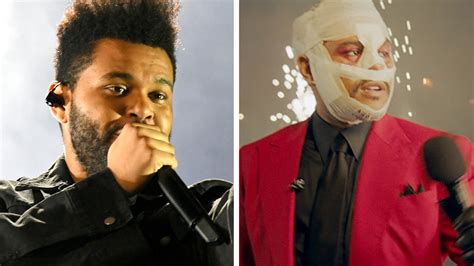 The Weeknd Finally Explains Those Face Bandages