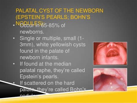 Summary Pediatric Oral Pathology