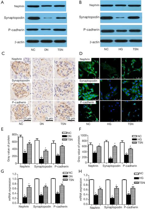 Effects Of Tang Shen Ning TSN On Nephrin Synaptopodin And