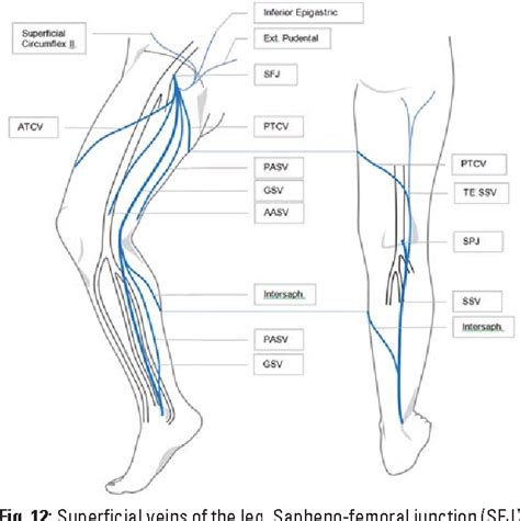 Duplex Ultrasound In The Assessment Of Lower Extremity Venous