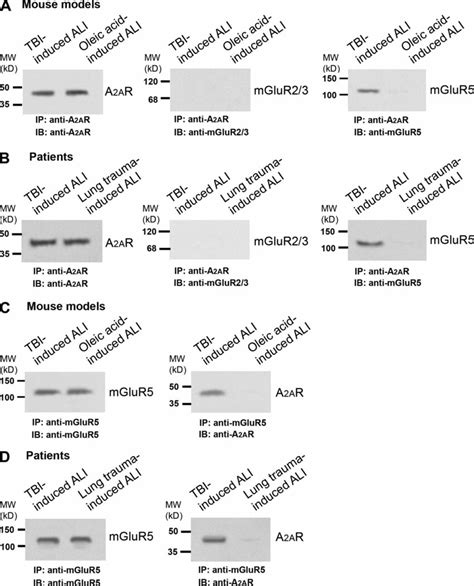 A Armglur Interaction Is Detected In Wbcs Of Severe Tbi Induced Ali