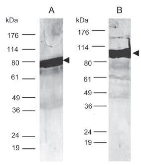 Western Blot Analysis Of Recombinant Hsp60 And Hsp70 With Anti P