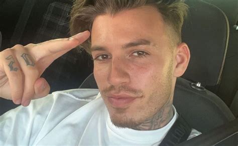 OMG Luca Van Ex On The Beach Ondergaat Cosmetische Ingreep