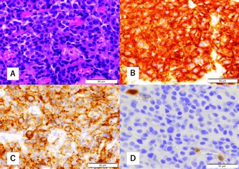 Histopathological Findings Of Biopsy Specimens Hematoxylin Eosin Hande