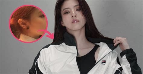 Actress Han So Hee Recently Underwent Nose Surgery Here S Why She