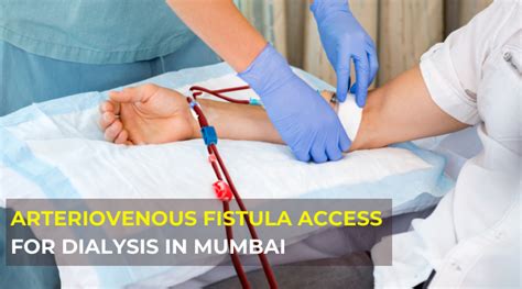 Arteriovenous Fistula Access For Dialysis Mumbai India Dr Jathins