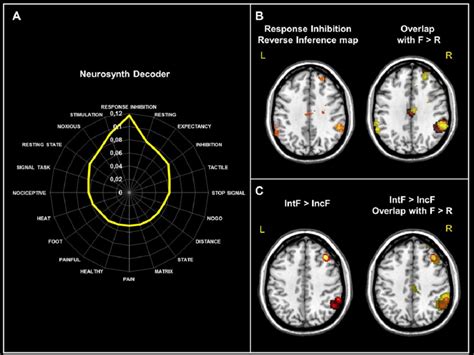 Reverse Inference Maps And Specific Fmri Activations Of Df A Spatial