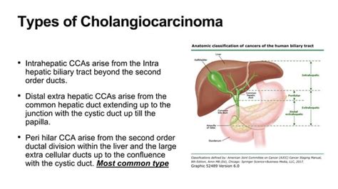 Cholangiocarcinoma Bile Duct Cancer Ppt