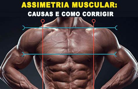 Assimetria Muscular Causas E Como Corrigir Dicas Treino Mestre