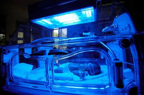 Bili Lights Phototherapy For Jaundice Shelly Lighting