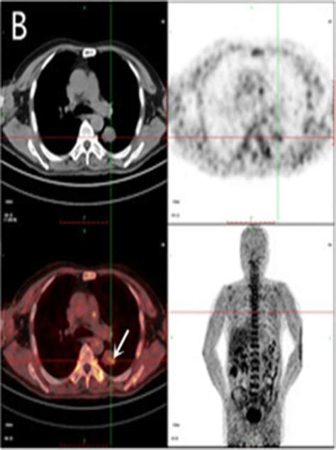 PET Imaging Major Organs And Regions Uptake At 2 H After Injection Of