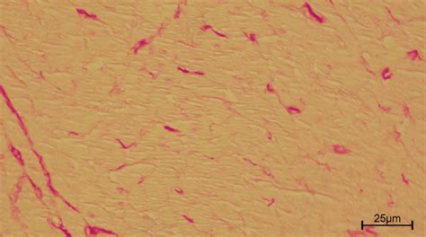 Representative Heart Tissue Sections Of Picrosirius Red Staining Download Scientific Diagram